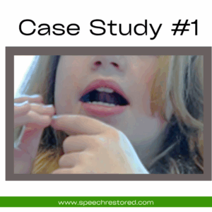 Person speaking, close-up of mouth.